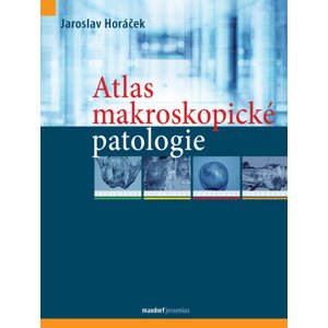 Atlas makroskopické patologie