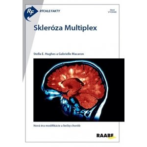 Rýchle fakty : Skleróza multiplex