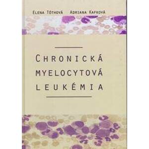 Chronická myelocytová leukémia - Kafková, Elena Tóthová Adriana