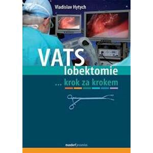 VATS lobektomie - Hytych Vladislav