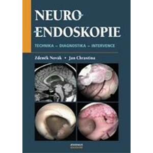 Neuroendoskopie - Zdeněk Novák, Jan Chrastina