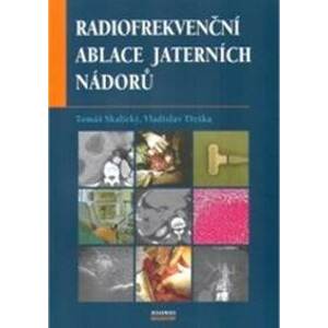 Radiofrekvenční ablace jaterních nádorů - Tomáš Skalický, Vladislav Třeška