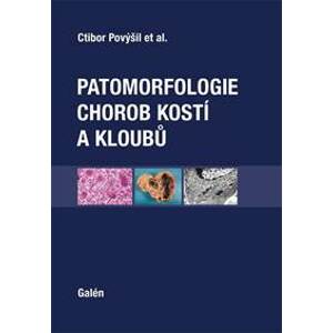 Patomorfologie chorob kostí a kloubů - Ctibor Povýšil
