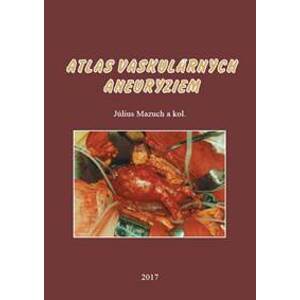 Atlas vaskulárnych aneuryziem - Július Mazuch, kolektiv