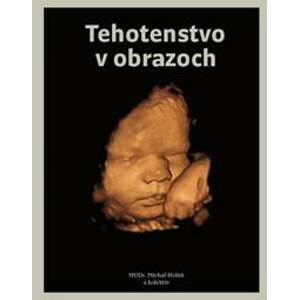 Tehotenstvo v obrazoch - Holáň a kolektív Michal