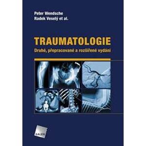 Traumatologie (Druhé, přepracované a rozšířené vydání) - Peter Wendsche, Radek Veselý