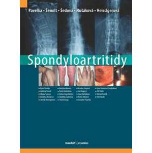 Spondyloartritidy - Pavelka Karel a kolektiv