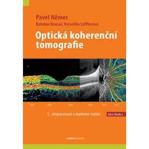 Optická koherenční tomografie - Kolektív