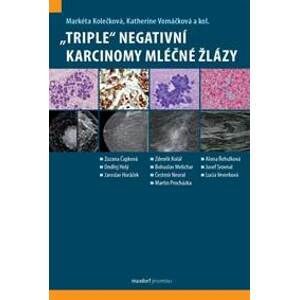 „Triple“ negativní karcinomy mléčné žláz - Kolečková, Katherine Vomáčková Markéta