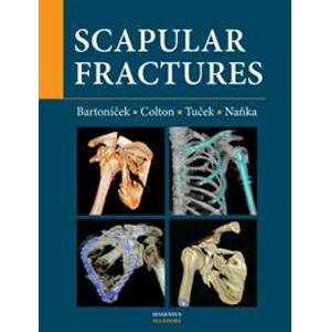 Scapular fractures - Jan Bartoníček, Christopher Colton, Michal Tuček