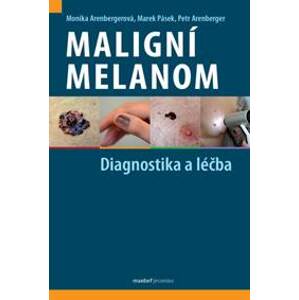 Maligní melanom - Monika Arenbergerová, Marek Pásek, Petr Arenberger