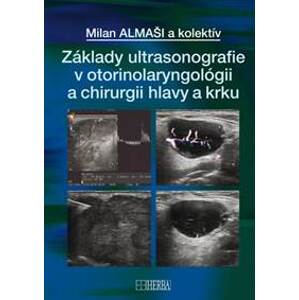 Základy ultrasonografie v otorinolaryngológii a chirurgii hlavy a krku - Milan Almaši, kolektiv